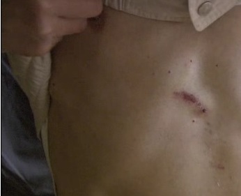 La víctima muestra dónde fue acuchillado